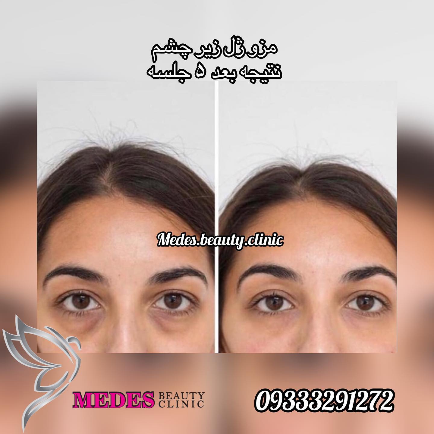 گالری مزوژل